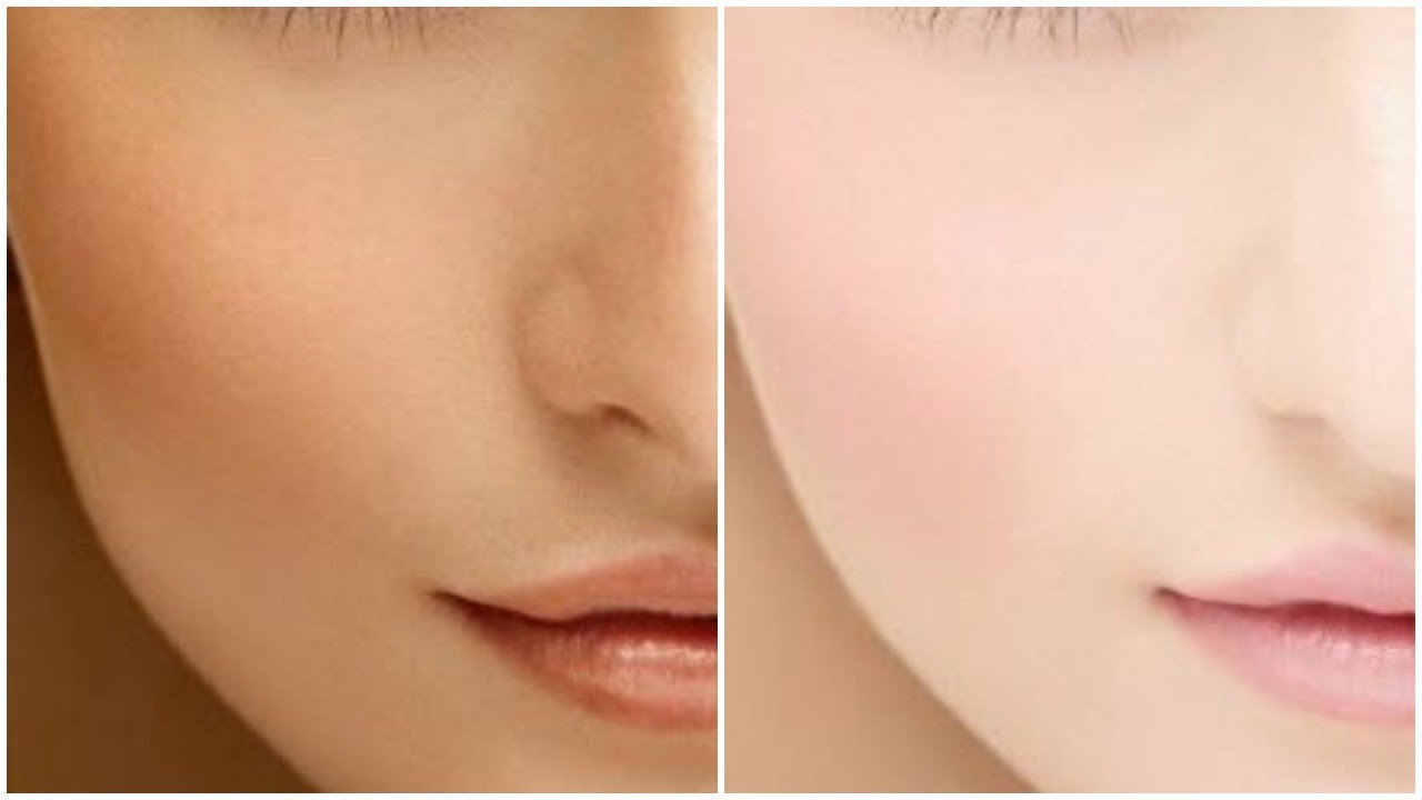 skin whitening